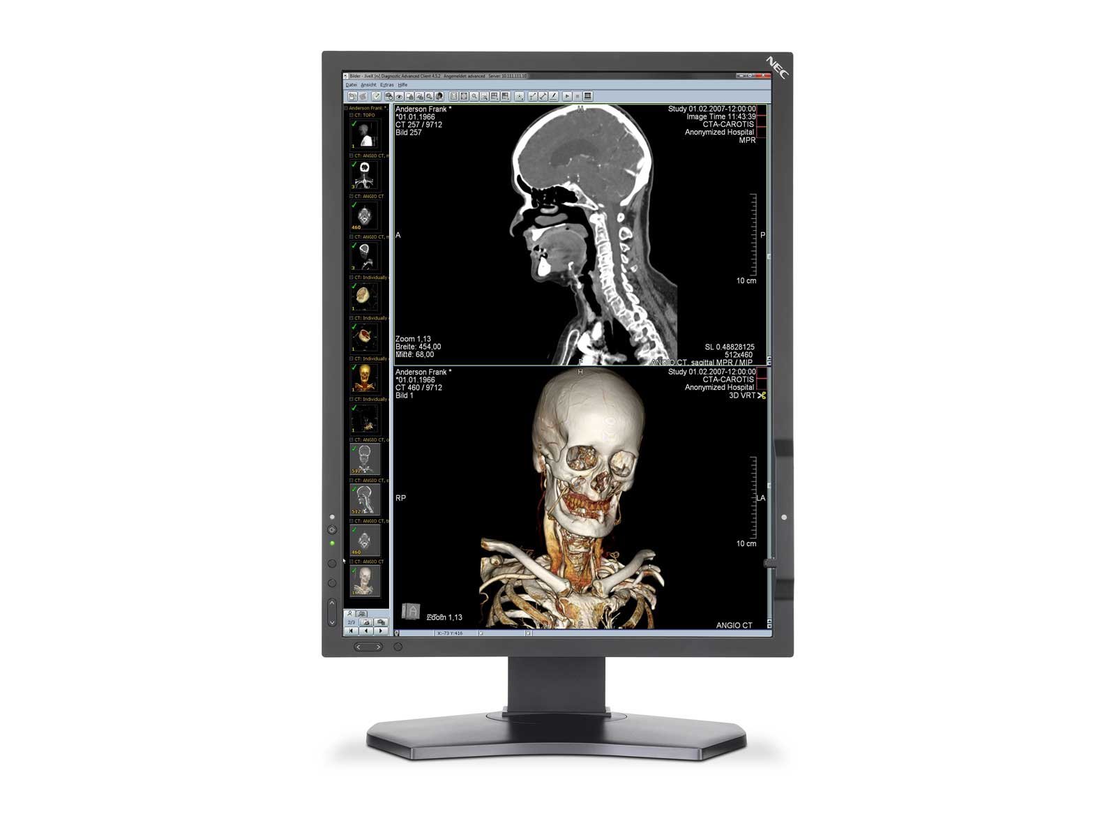 NEC MDC212C2-270