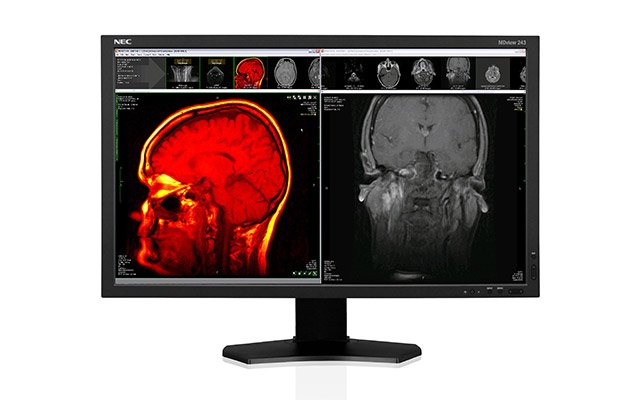 Press2013-Products-MDview243